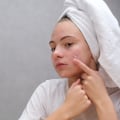 Avoiding Harsh Scrubbing: The Ultimate Guide to Skincare for Acne-Prone Skin