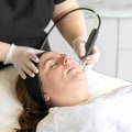 A Complete Guide to Microdermabrasion: Treating Acne and Caring for Your Skin