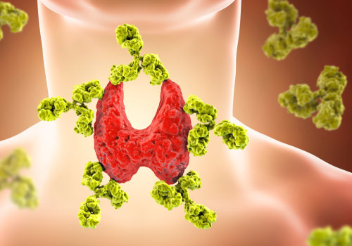 Understanding Thyroid Disorders: Causes, Treatment, and Prevention