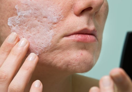 Diet Modifications for Preventing and Managing Breakouts
