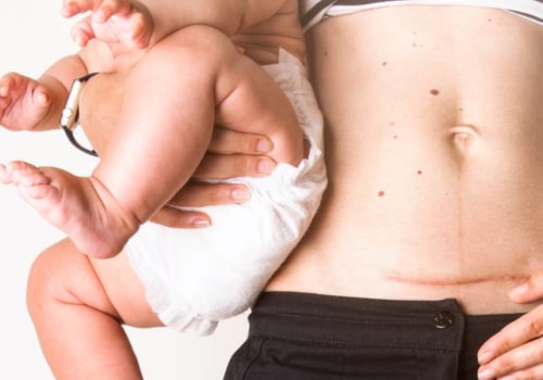 Understanding Pregnancy and Postpartum: A Comprehensive Guide