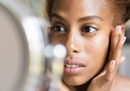 Moisturizing for Acne Prevention and Management