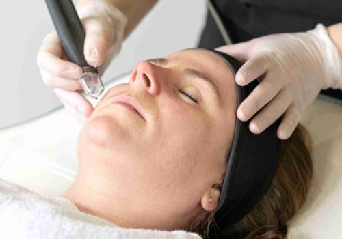 A Complete Guide to Microdermabrasion: Treating Acne and Caring for Your Skin
